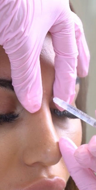 Anti Wrinkle Treatment available at Rebecca Slane Skin , Alderley Edge Cheshire, Using Azzalure to temporary relax muscle movement & give you glowing skin. Local to Wilmslow, Knutsford, Prestbury, Macclesfield, Altrincham & Manchester.