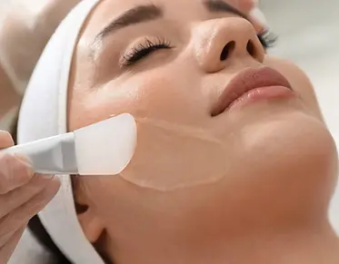 Chemical Peel