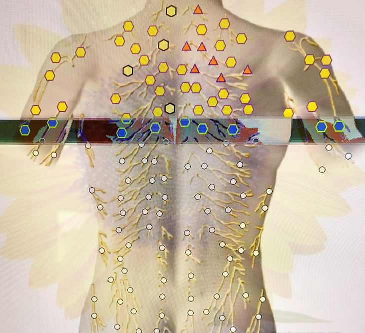 Computerized Bioresonance Therapy