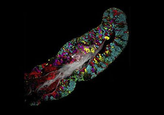 Trillones de Virus y Bacterias Viven Dentro de la Boca Humana, Especialmente en la Lengua, Revela un