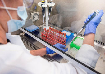 AstraZeneca podría tener la vacuna contra el covid-19 a partir de septiembre