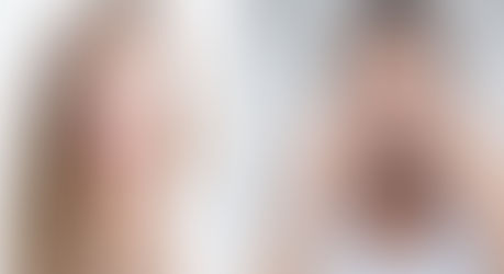 Ácido Salicílico, ¿enemigo de nuestra piel?