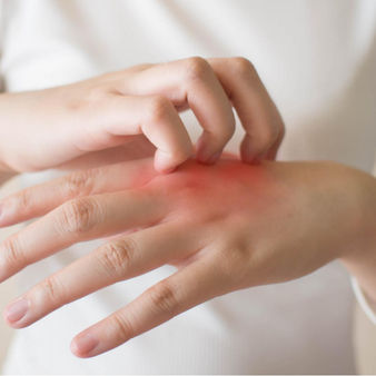 Las mejores cremas para nuestras manos según los dermatólogos