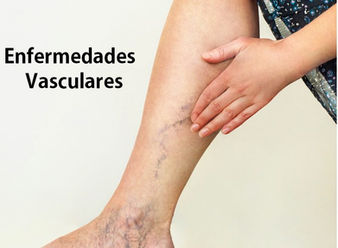 Enfermedades vasculares, cuando nuestro sistema circulatorio se ve afectado