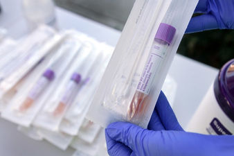Alemania donó 100,000 pruebas de coronavirus a México