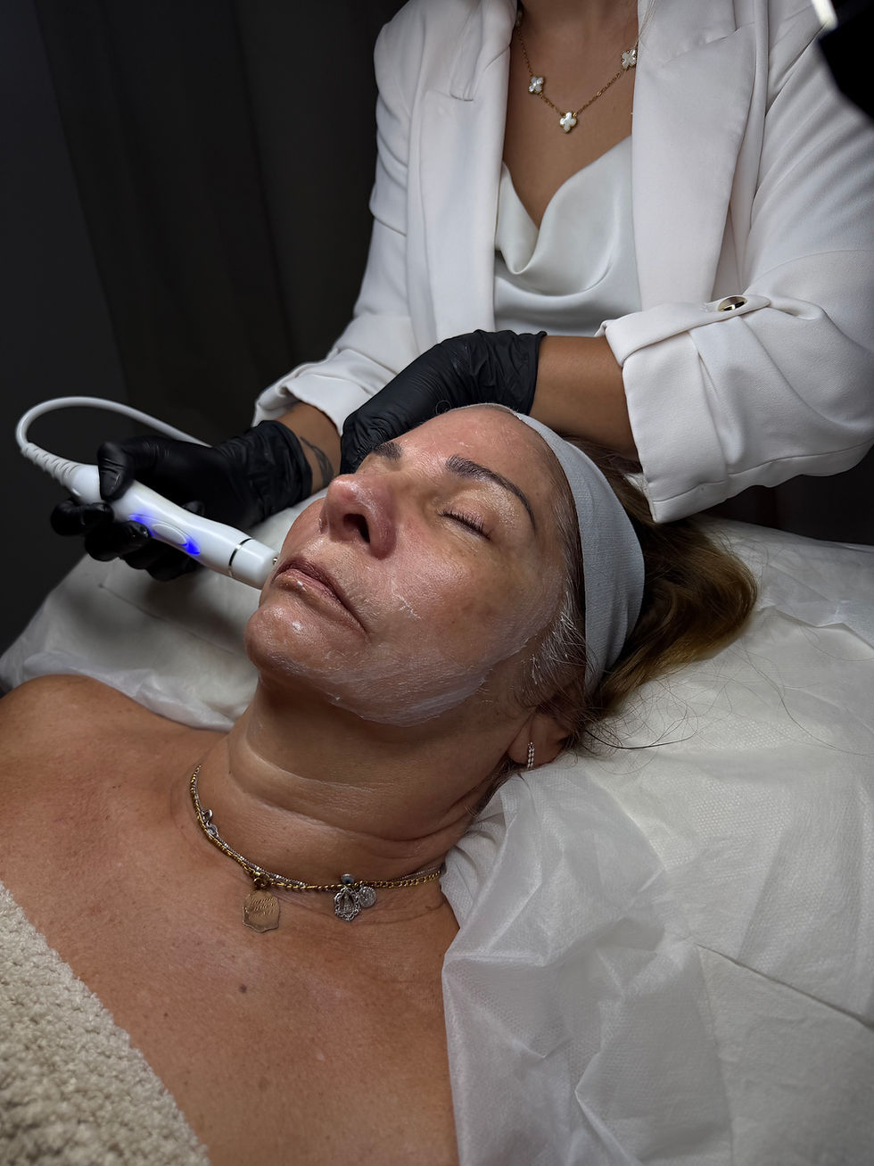 Microdermabrasion