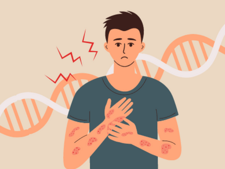 The Blueprint of Skin Health—Genetics, Eczema, and Psoriasis