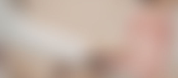 孕期MPN照護與治療的利弊權衡-從最新研究談Ropeginterferon alfa-2b 的安全性