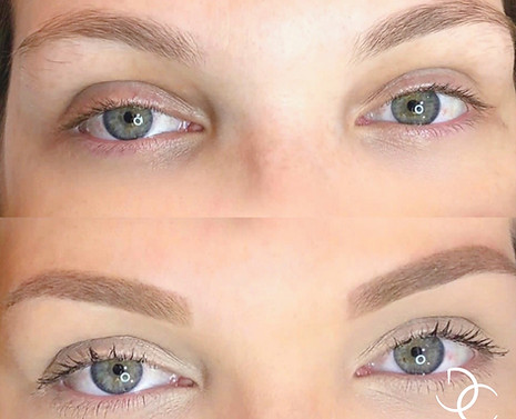 Effet poudré Dermo Clinic