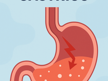 Problemas Gástricos: Consequências dos Medicamentos e Alternativas para Tratar a Causa