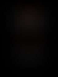 "SENCILLO, QUE NO SIMPLE"