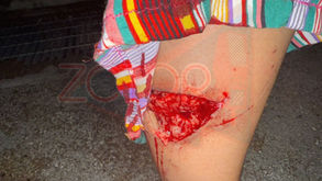 Vecinos de Ciudad Caucel Piden Intervención por Perro Callejero Agresivo