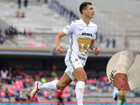 ¿Y el VAR? Así quedó la pierna de Juan Ignacio Dinenno tras el Pumas vs Atlas