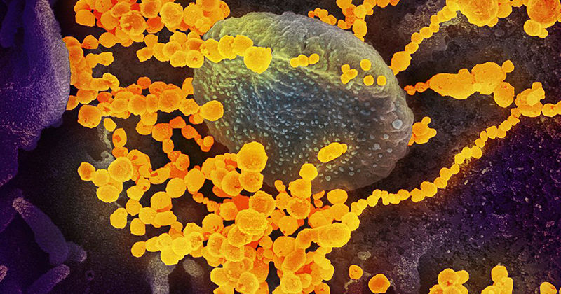 Mutações do genoma do vírus que o tornam mais infeccioso em humanos surgem aleatoriamente durante sua replicação e, por serem imperfeitas, é pouco provável a hipótese de terem sido produzidas pelo homem – Foto: NIAID via Wikimedia Commons (CC 2.0)