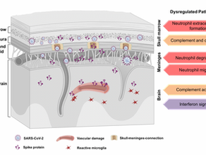The Brain and Long Covid