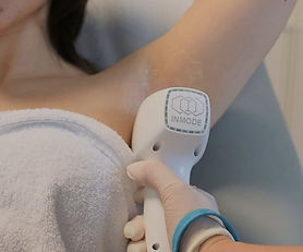 Permanent hair removal