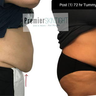 premierskintight.png.png