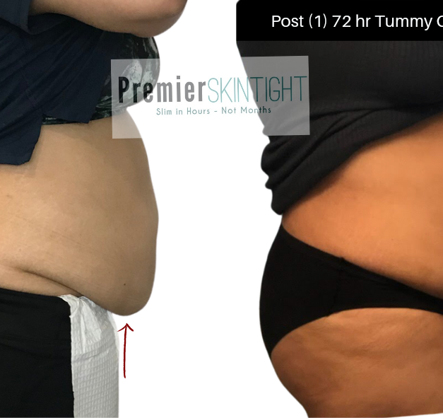 premierskintight.png.png