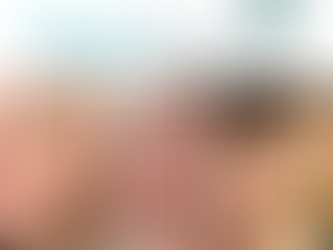 Why Fibroblast’s Treatment Eliminates the Need For Traditional Skin Tightening 