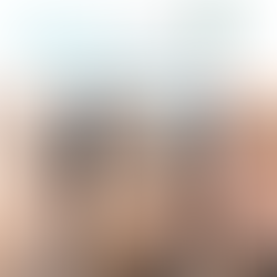 The Hottest New Trend In Skin Tightening Just For You