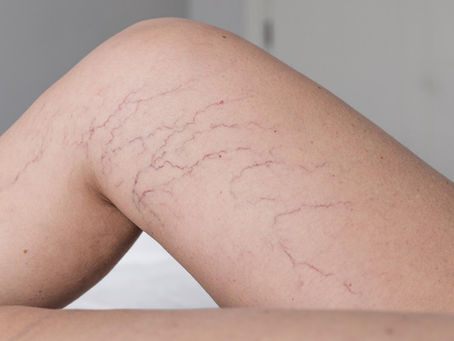 O que não te contam sobre os vasinhos: nem tudo é estética!