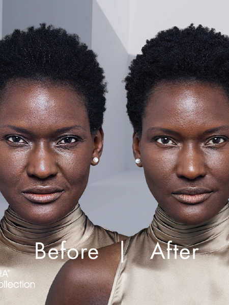 before-after-screens-copy_0002_rha3--revance.png