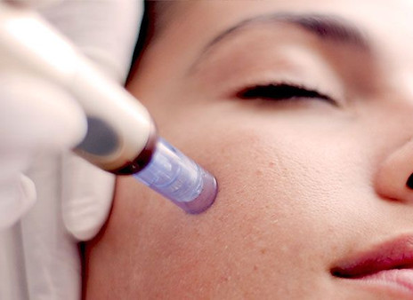BB GLOW MICRONEEDLING6.jpg