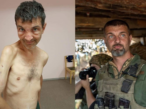 Un prisionero de guerra ucraniano fue liberado por el ejército ruso: el estremecedor antes y después