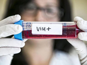 VIH: un paciente en Alemania es el tercer caso confirmado de curación