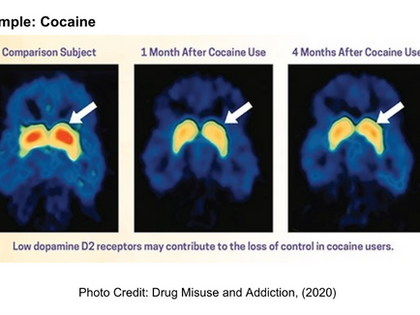 Heroin and the Brain