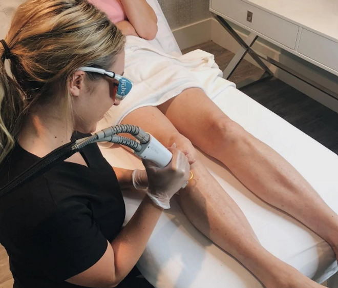 Women's Full Leg Laser Hair Removal at Nina L'Allure.png