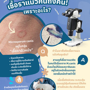 เชื้อราในแมวติดคนได้จริงหรือ? อาการคันจากแมวสู่คน สาเหตุ และแนวทางการรักษา