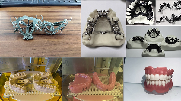 tooth frame.png