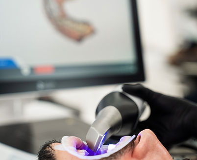 dental intraoral scanner used by stomatology clinic doctor examines teeth pat
