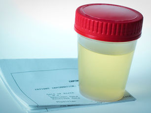 Urine Drug Testing