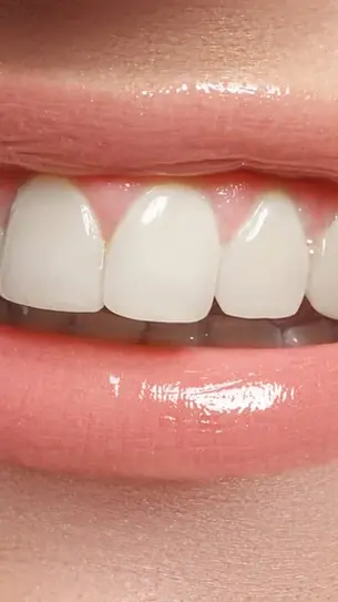 Tongue Thrust Exercises to Strengthen Your Tongue & Improve Your Smile