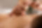 The doctor sticks needles into the girl's body on the acupuncture - close up.jpg