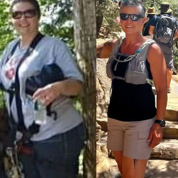 Before and After images of Lynette