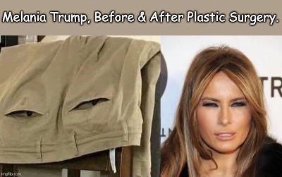 Midnight Meme Of The Day! Melania's Former Life As A Pair Of Pants