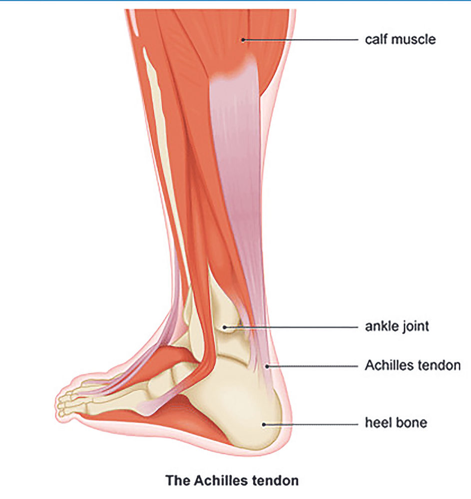 Why am I getting pain in my heel or achilles tendon?
