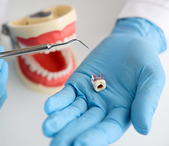 Root-Canal-Treatment-.jpg