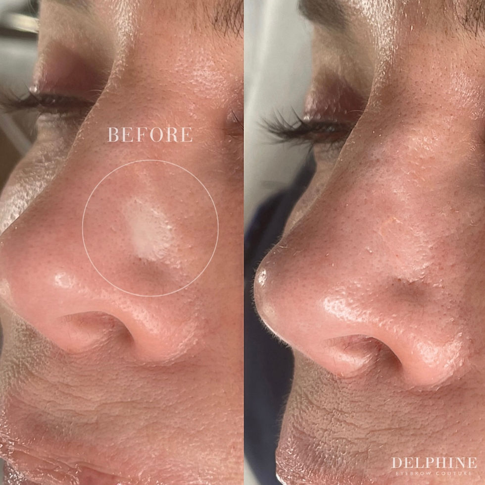 Side-by-side close-up of a woman’s nose and eye, labeled BEFORE and DELPHINE EYEBROW COUTURE, showing skin texture.