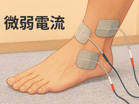 微弱電流(マイクロカレント)治療とは?疲労回復・ケガの早期改善に役立つやさしい電気施術