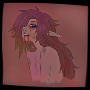 noname bruises.png
