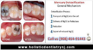 Mercury Detoxification  Treatment In NJ/NYC-Dr. Philip Memoli