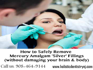 How to Safely Remove Mercury Amalgam Silver Fillings