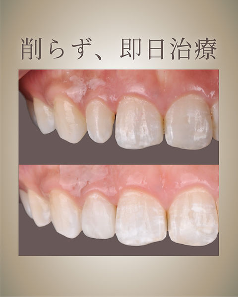 症例0704-1.jpg