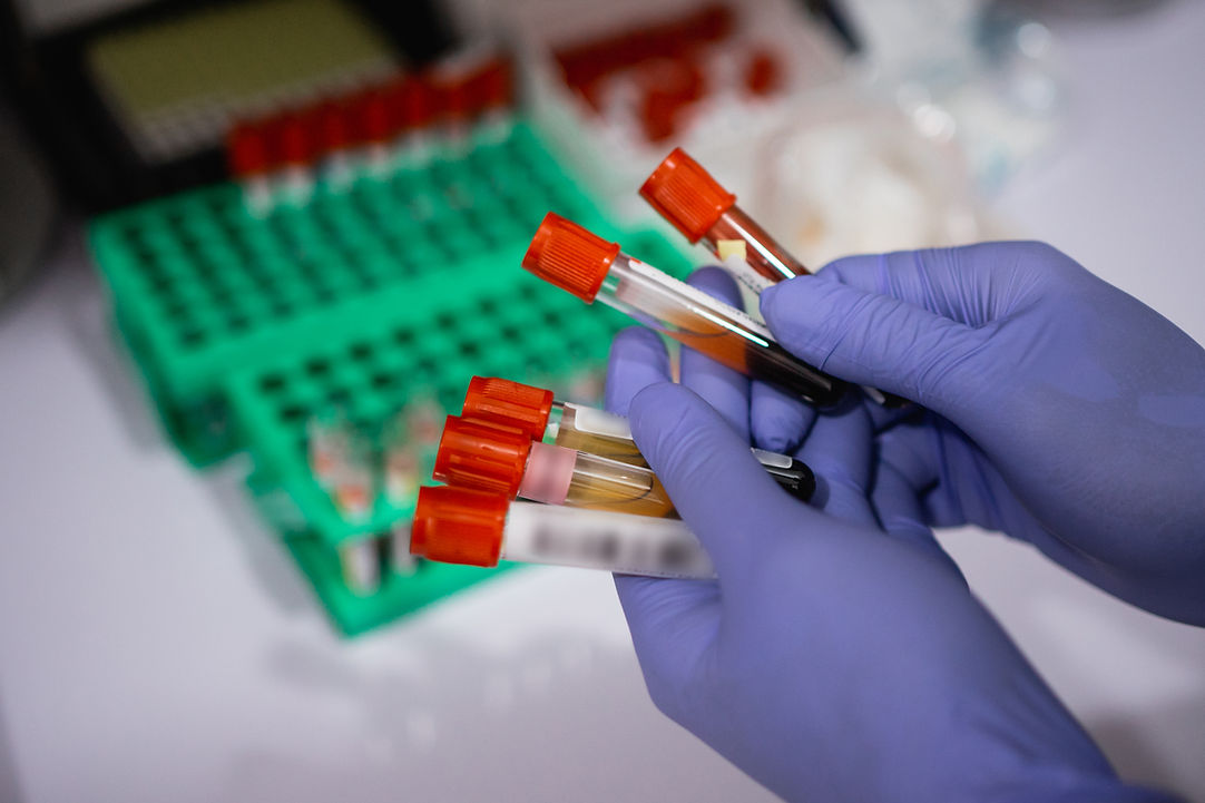 gloved-hands-holding-marked-blood-ampoule-bottles-with-shelves-background.jpg