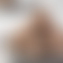 Almond Joy Protein Bites