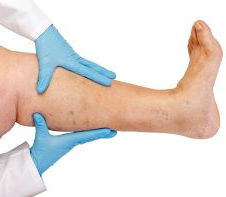 הייתי צריכה לעבור ניתוח ברגל - הסיפור המלא אורן זריף